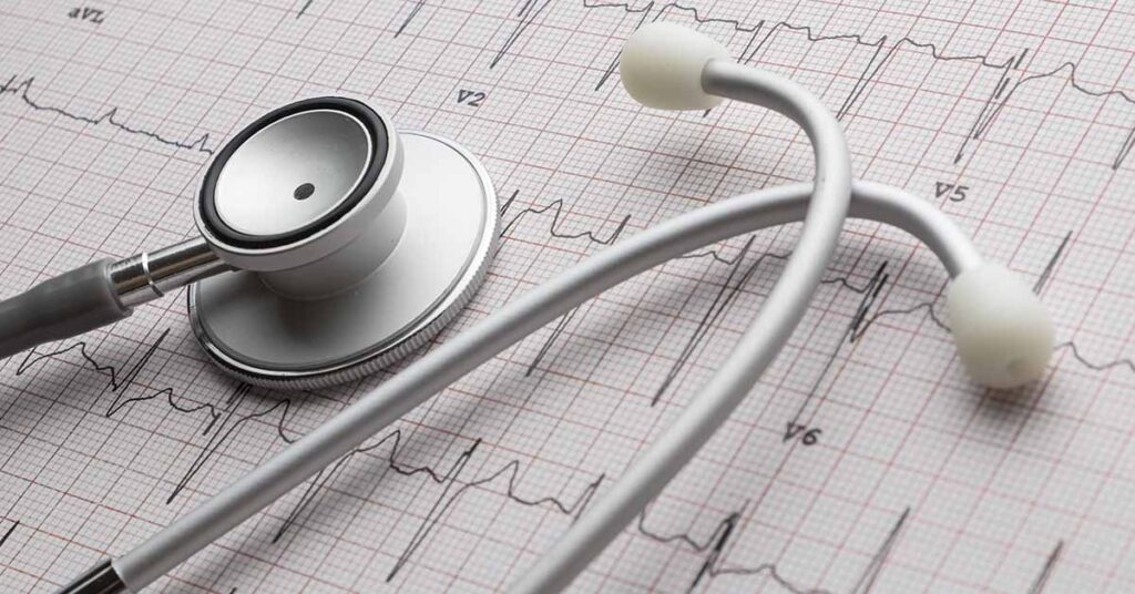 Estudo eletrofisiológico com Ablação: o que é e quando está indicado 2 Estudo eletrofisiológico com Ablação: o que é e quando está indicado