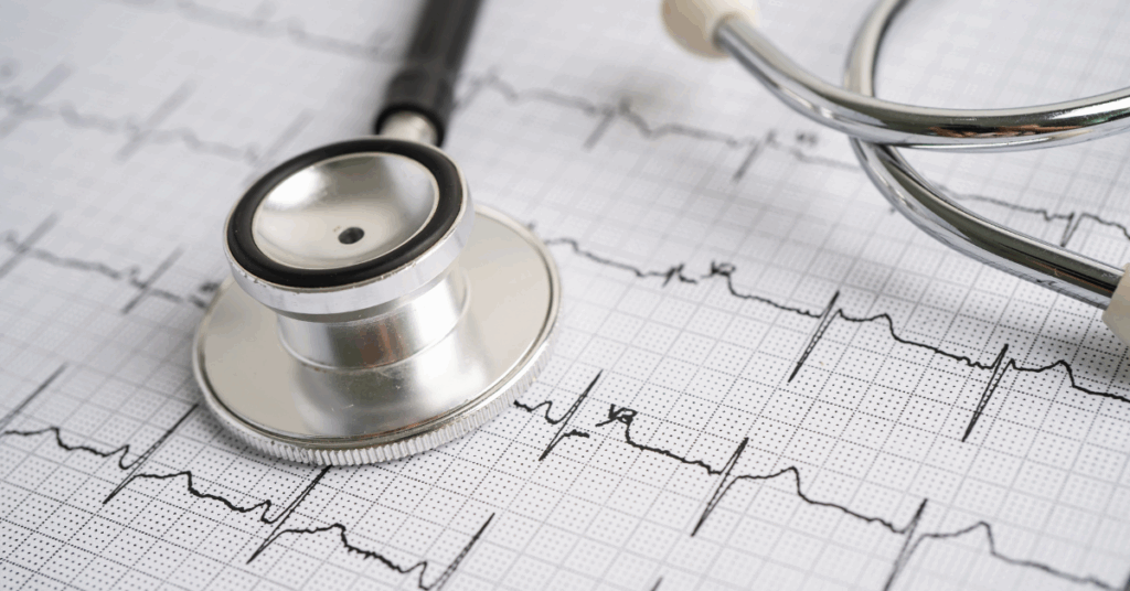 Diferenças entre Bradiarritmias e Outras Arritmias Cardíacas 1 4.1 Diferencas entre Bradiarritmias e Outras Arritmias Cardiacas