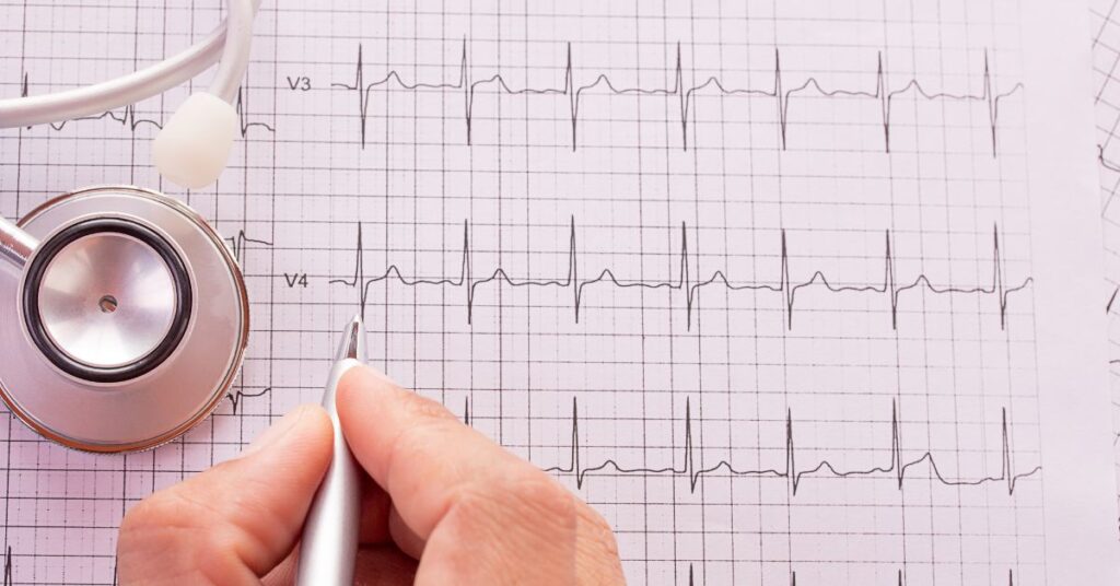 Disritmia cardíaca: tipos, sintomas e exames indicados